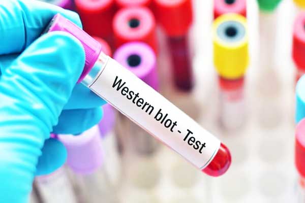 اختبار Western Blot